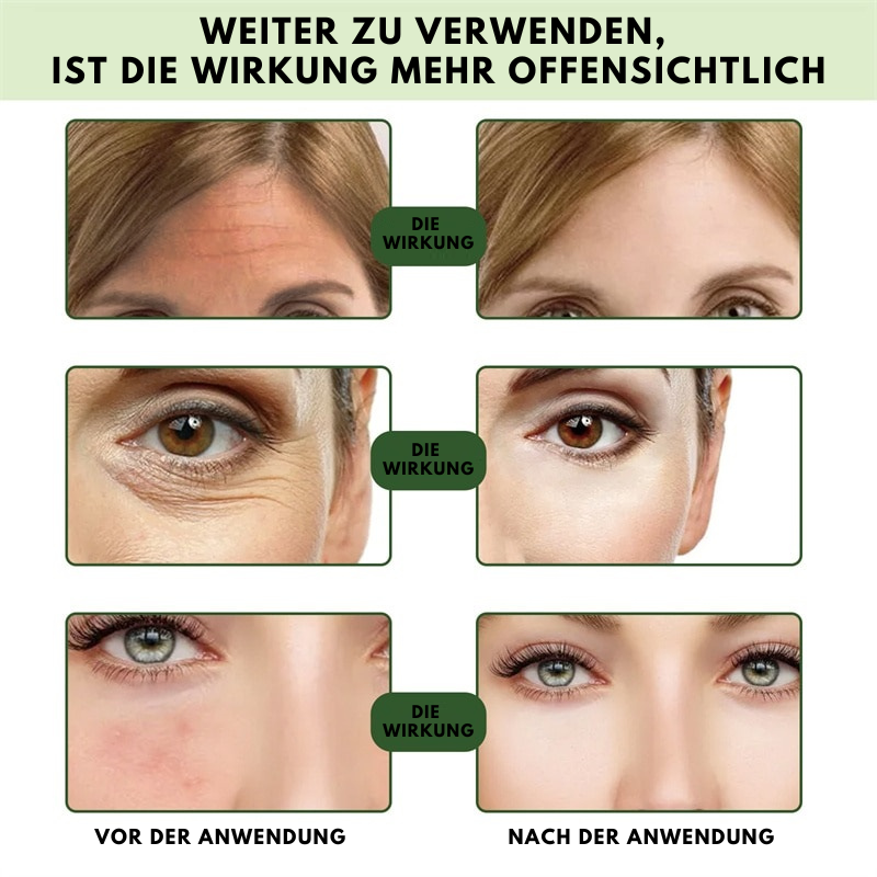 SkinReju™ - Ceramid Lifting Serum (1+1 GRATIS)